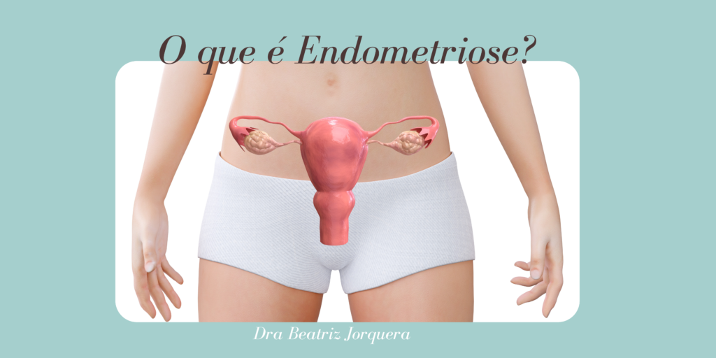 O que significa cada cor na menstruação? - Dra. Beatriz Jorquera